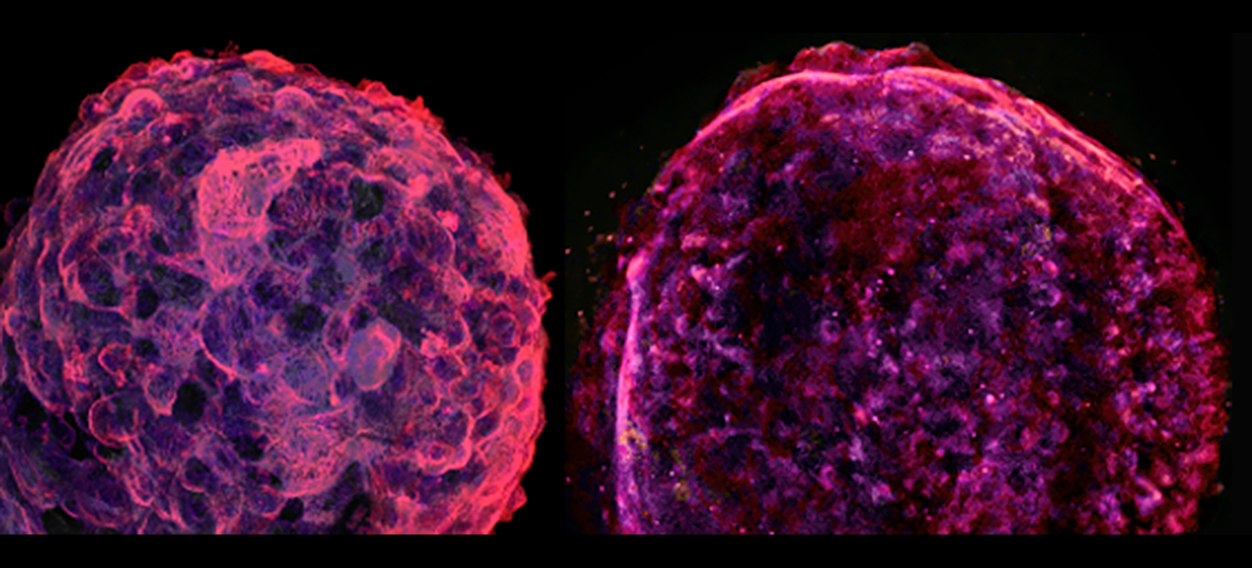 Cardiac Organoid  vs.  Supernova 1006