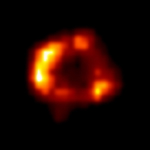 SN 1987A Image
