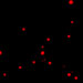 Chandra X-ray Image of M74