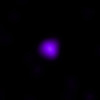 X-ray image